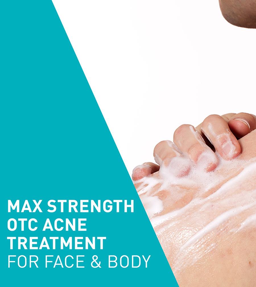 Acne Foaming Cream Wash - Image 5