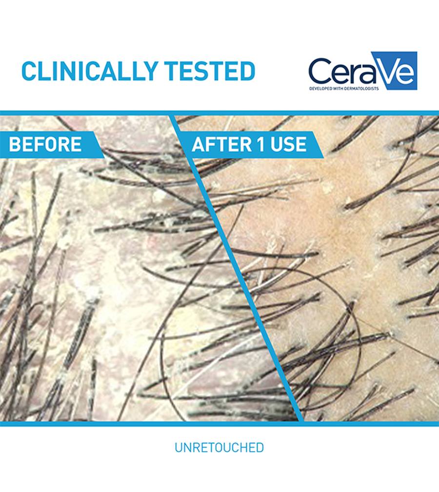 Anti-Dandruff Hydrating Shampoo - Image 3