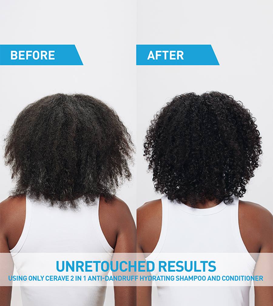 2-in-1 Anti-Dandruff Hydrating Shampoo and Conditioner - Image 5