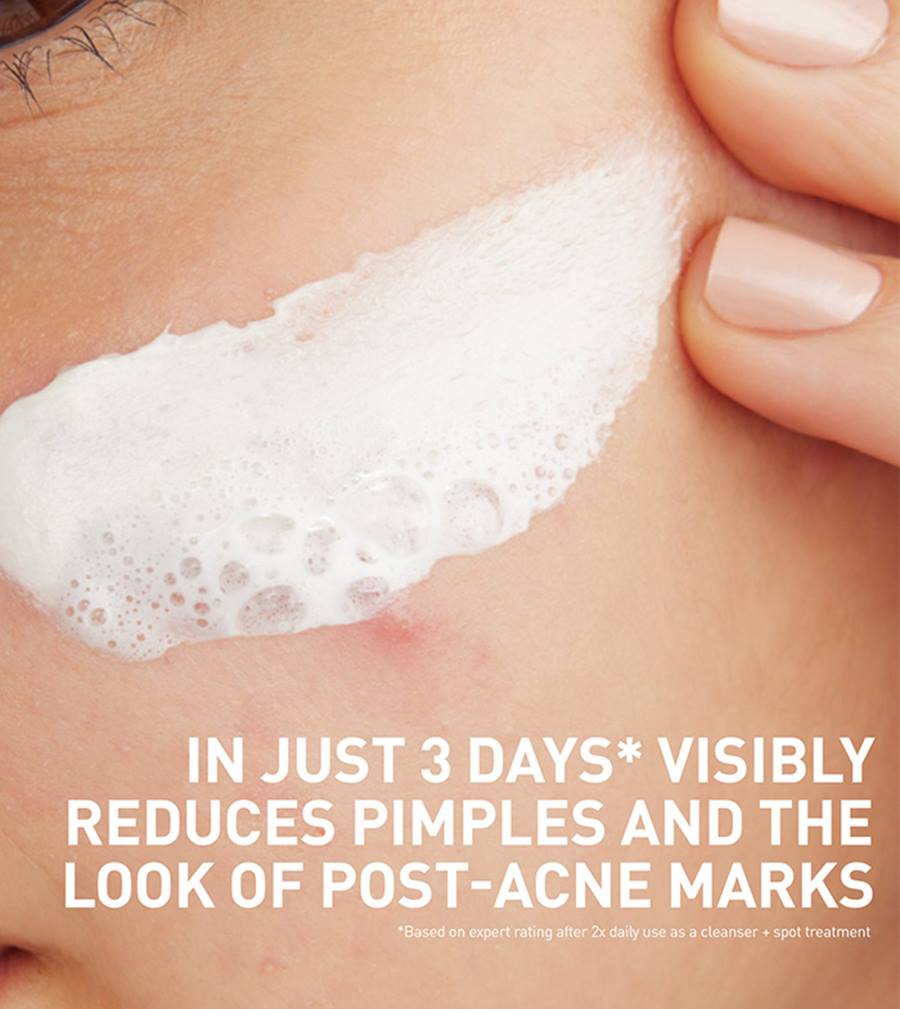 Acne Clay To Foam Cleanser - Image 2