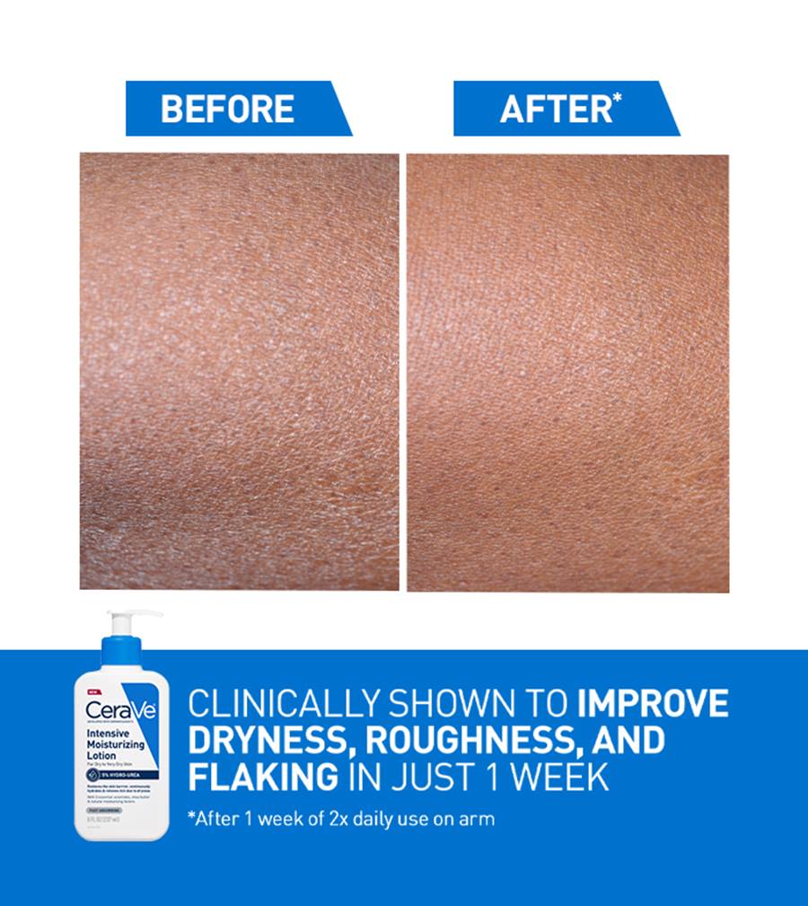 Intensive Moisturizing Lotion - Image 2