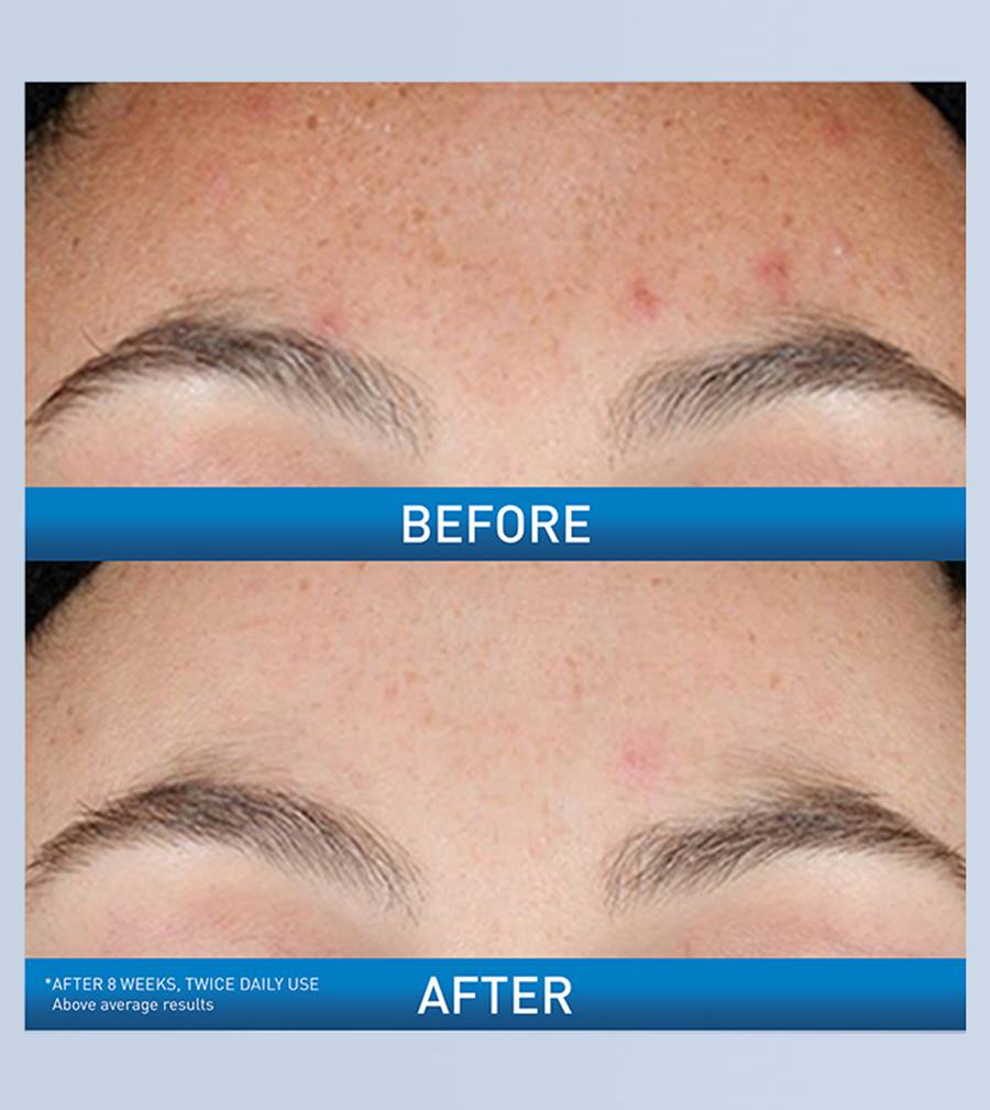 Resurfacing Retinol Serum - Image 3